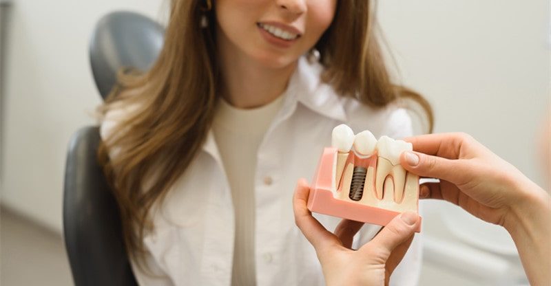 Correct Care For Your Dental Implants And Overdentures