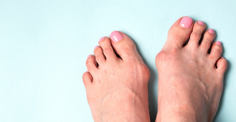 Frequent Foot Issues You Can Expertise In Life