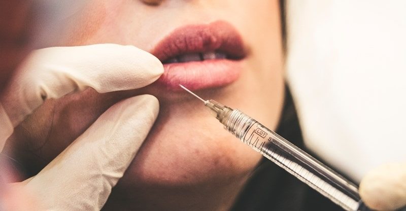 What You Ought to Know About Dermal Fillers