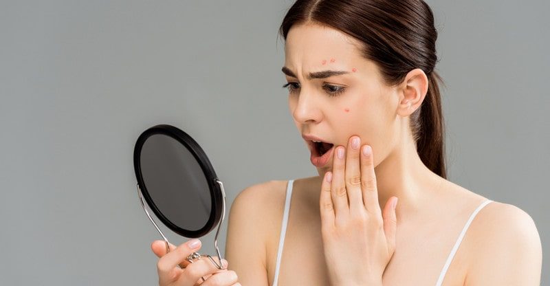 5 Causes To Take into account Probiotics For Zits